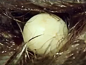 echidna egg in mother's pouch