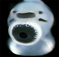 Box jellyfish eye
